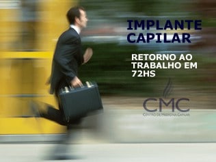 IMPLANTE CAPILAR RETORNO AO TRABALHO