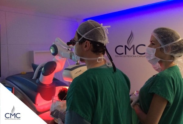 unidades foliculares em transplante capilar artas
