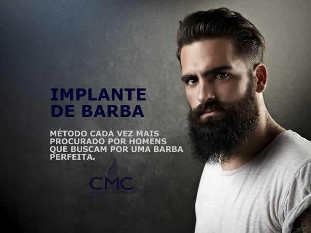 implante de barba