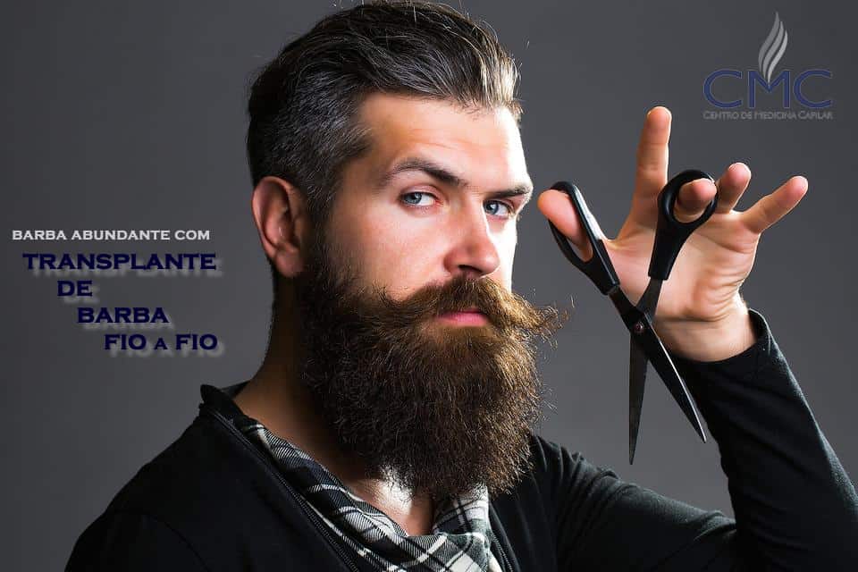 transplante de barba