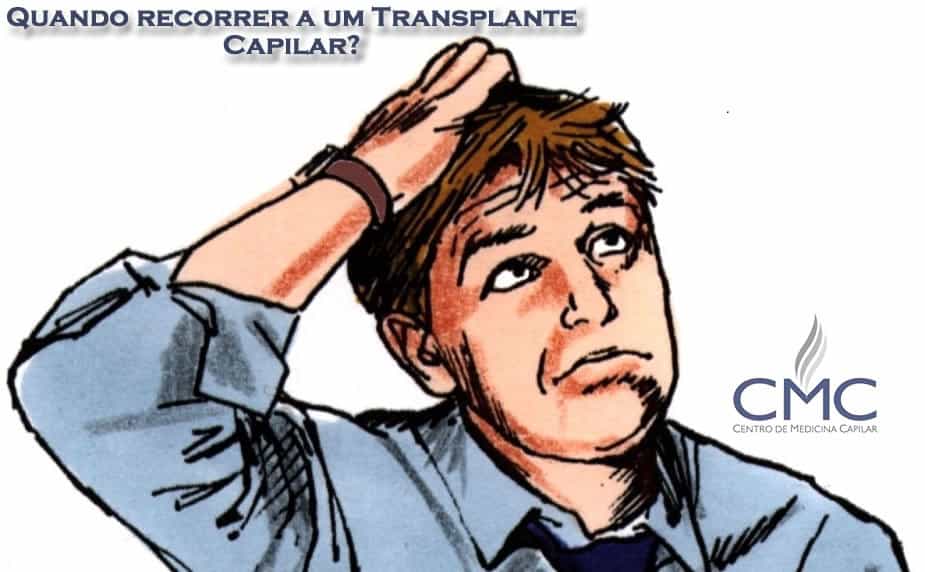 implante capilar