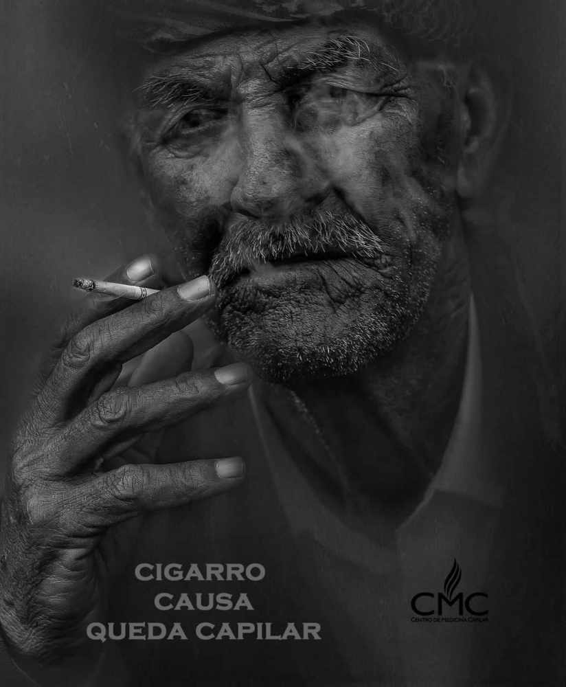 cigarro queda de cabelo